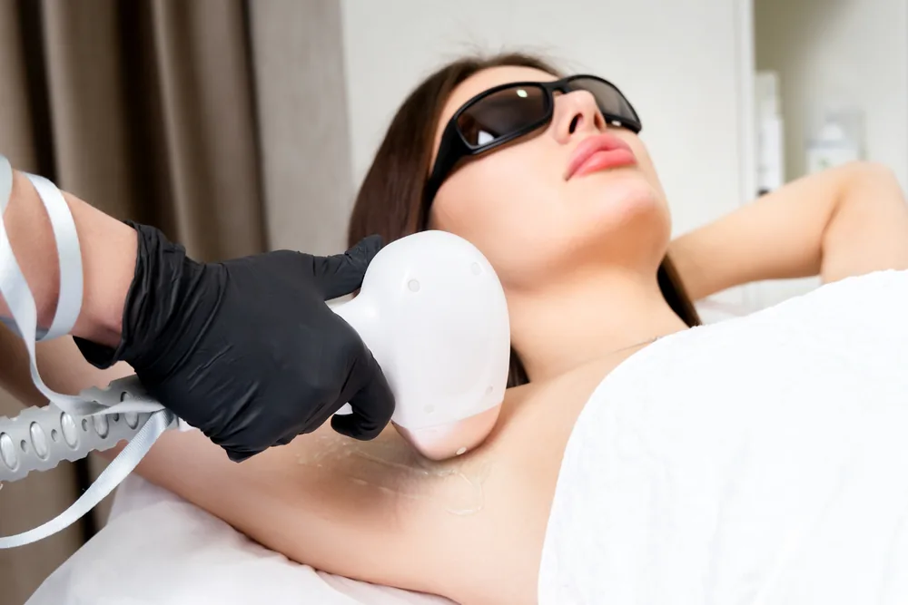 Aplicação de laser de depilação na axila, com óculos de proteção
